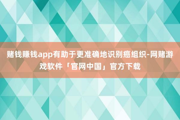 赌钱赚钱app有助于更准确地识别癌组织-网赌游戏软件「官网中国」官方下载